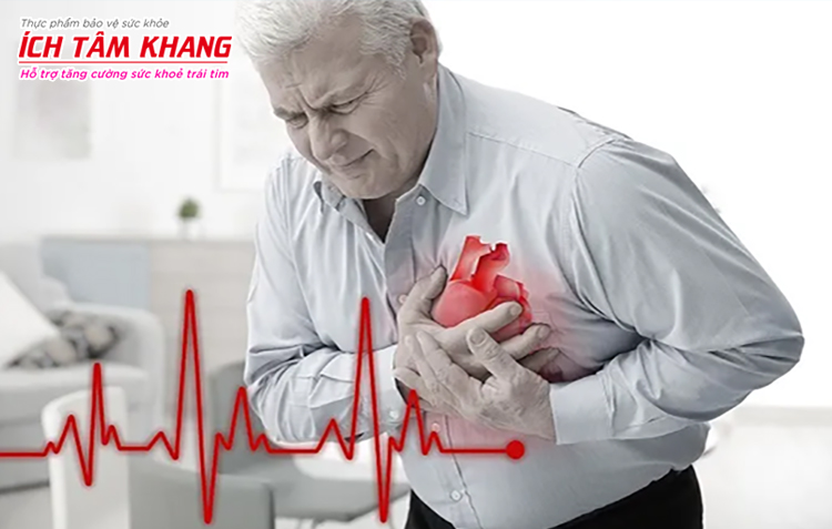 Ngoại tâm thu thất nhịp đôi có thể làm tăng nguy cơ nhồi máu cơ tim